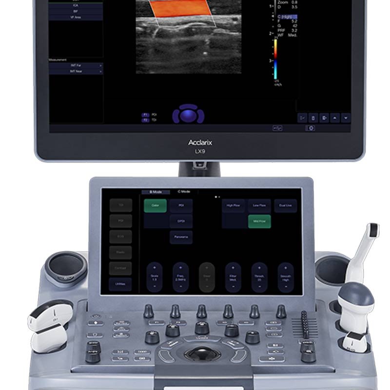 ACCLARIX-LX9-II